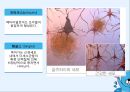 제누피그에 대한 모든것 ppt 발표자료 A++ - 치매유전자를 보유한 복제돼지, 제누피그.pptx 4페이지