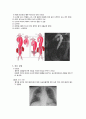 [ICU] 대동맥박리 케이스 6페이지