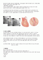 STEMI(ST분절상승 심근경색) 케이스 5페이지