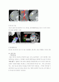 간암 케이스 스터디 (Liver Cancer) 10페이지