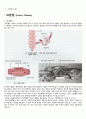 Crohn’s disease(크론병) case study 3페이지