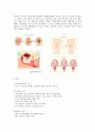 Cesarean section(제왕절개) case study 4페이지