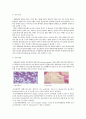 Aplastic anemia(재생불량성 빈혈) case study 4페이지