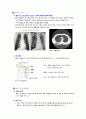 자연 기흉 (pneumothorax) 일차성 기흉  case study 5페이지