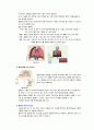 자연 기흉 (pneumothorax) 일차성 기흉  case study 7페이지