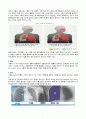 기흉 케이스  4페이지