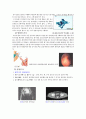 방광암 케이스 (방광암 방광암 케이스 방광암 간호과정 방광암 case study 방광암 사례관리 비뇨기과) 9페이지
