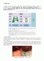 직장구불결장 이행부 암 케이스 스터디 ( 직장암 케이스 결장암 케이스 Rectosigmoid junction cancer 간호과정 4개) 10페이지