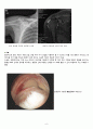 회전근개 파열 케이스 (Rotator Cuff Tear  회전근개파열 케이스 회전근개파열 회전근개 파열 간호과정) 7페이지