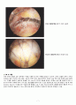 회전근개 파열 케이스 (Rotator Cuff Tear  회전근개파열 케이스 회전근개파열 회전근개 파열 간호과정) 8페이지