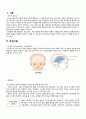 수두증 (hydrocephalus 뇌수종) - 수두증 케이스 뇌수종 케이스 2페이지