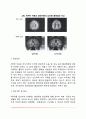 [행동장애] 주의력결핍과잉행동장애(ADHD)와 품행장애의 원인과 증상 및 치료방법 3페이지
