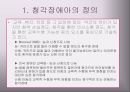청각장애아의 특성과 지도 5페이지