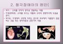 청각장애아의 특성과 지도 8페이지