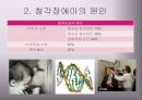 청각장애아의 특성과 지도 11페이지