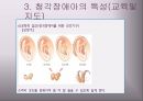 청각장애아의 특성과 지도 25페이지
