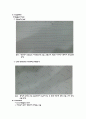 case - Stroke Lt hemiplegia 5페이지