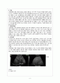 간경변Liver Cirrhosis case 6페이지