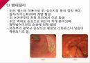 A+소화성궤양 6페이지