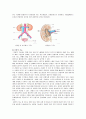 성인간호학 실습케이스 신장암 케이스( Renal cell carcinoma) 4페이지