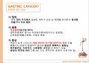 위암환자 간호과정을 통해 본 영양 지원 적용 ppt 4페이지