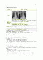 지역사회획득 폐렴 7페이지