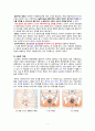 복압성요실금 5페이지