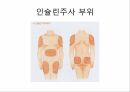 인슐린과 당뇨병인슐린이란인슐린 부작용인슐린의 종류 11페이지