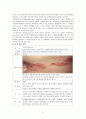 병리학 헤르페스 바이러스 Herpes viruses 1형 2형 3형 단순포진 대상포진 14페이지