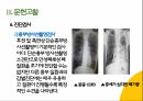 COPD(만성폐쇄성폐질환) 간호과정 PPT A+자료 12페이지