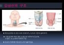 갑상선암갑상선의 구조암의 정의갑상선 암의 원인갑상선의 기능 2페이지