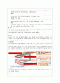 성인간호학 Laparoscopic Cholecystectomy Case study 7페이지