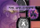 치매,섬망,기억인지장애,기질성 정신장애란,감염물질설,유전적 요인,대사장애,알츠하이머형 치매,혈관성 치매,파킨슨 치매 1페이지