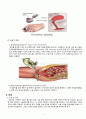 자궁하수증 자궁탈출증 케이스A+ 간호과정 및 간호진단 2개 이론적근거 6페이지