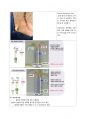 혈관조영실 시술과 간호 및 각종 배액관 12페이지