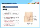 아동간호학 - 잠복고환 조별과제 ppt 3페이지
