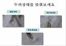 두피관리 임상과 실제 26페이지