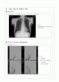 성인간호학] 뇌동맥류 ( Cerebral aneurysm) 케이스 스터디 (case study) 및 문헌고찰 , 신경외과 실습 17페이지