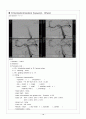 성인간호학] 뇌동맥류 ( Cerebral aneurysm) 케이스 스터디 (case study) 및 문헌고찰 , 신경외과 실습 18페이지