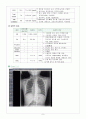 아동간호학] 폐렴( Pneumonia ) 케이스 스터디 (case study) 및 문헌고찰 , 소아과-PED 실습 9페이지