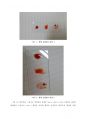 레포트 ABO식 혈액형 판별 및 혈구관찰  a+ 자료 2페이지