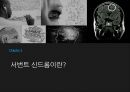 서번트 신드롬 특수교육 특수 아동 특수아동이란 자폐증 특수교육이란 6페이지