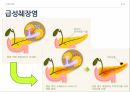 췌장염 NCP과정 췌장의 기능 췌장염 췌장이란 췌장염이란 급성췌장염 8페이지