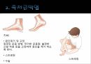 스포츠상해 예방 및 처치 - 빙상 15페이지