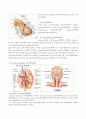 SICU_cerebral infarction 7페이지
