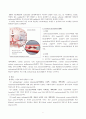SICU_cerebral infarction 9페이지