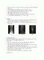 성인간호학 ankle fracture case study 간호과정 3개 6페이지
