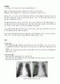 A+ 성인간호학실습 응급실 기흉 Pneumothorax 케이스 A+ 간호과정 3개, 응급실 장비, LAB 7페이지