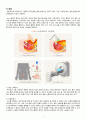 A+ 모성간호학실습 난소종양 Benign ovary tumor 케이스 A+ 문헌고찰 간호진단, 간호과정 2개 5페이지