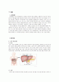 간경화증(간경변증)Liver Cirrhosis case2 1페이지